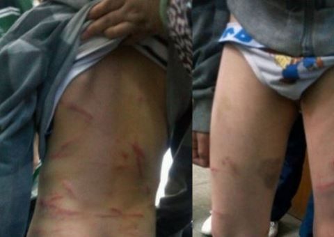 Garoto é espancado diariamente por madrasta que não consegue ter filho