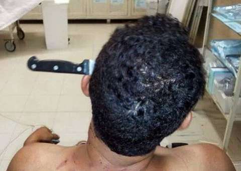 Homem crava faca na própria cabeça depois de brigar com namorado