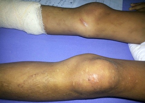 Madrasta é suspeita de agredir criança de cinco anos em Manaus