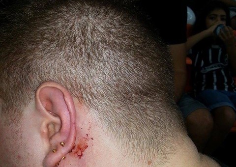 Torcedor é agredido por cambista no jogo entre Corinthians e Nacional