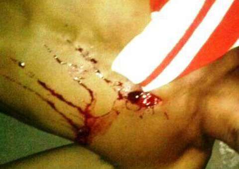 Mulher mata marido com facada no peito em Maués