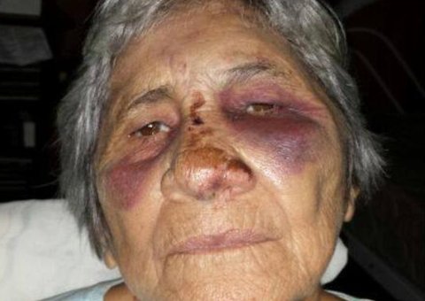 Senhora de 72 anos é espancada gratuitamente por jovem em Manaus