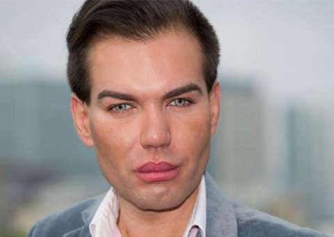 Brasileiro gasta R$ 370 mil para ficar igual ao boneco Ken