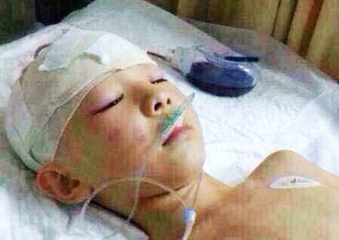 Professor com fama de bonzinho espanca garotinha e ela entra em coma