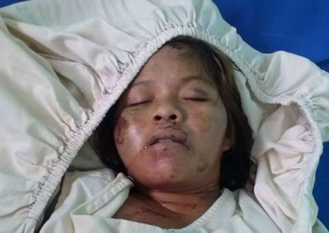 Índia grávida é espancada no Amazonas. Marido tentou tirar bebê usando pedaço de pau