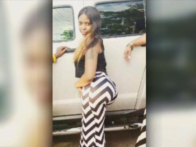  Americana morre após ficar viciada em hidrogel para ter "bumbum brasileiro"