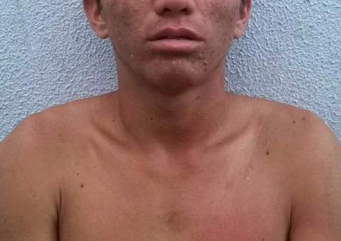  Durante patrulha, PMs flagram dupla roubando celular de estudante na Cidade Nova