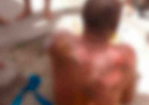  Cobrador idoso é queimado em incêndio criminoso a ônibus em Salvador