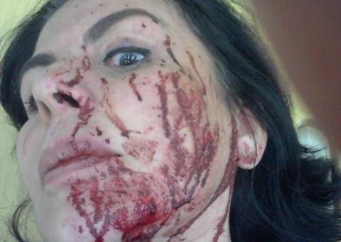  Esposa do humorista Castrinho é baleada de raspão após 2 tentativas de assalto