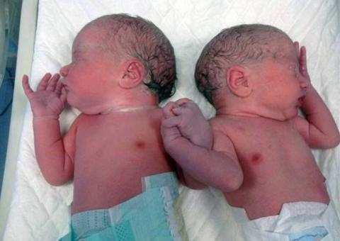 Gêmeos recém-nascidos dão as mãos e fazem sucesso na web