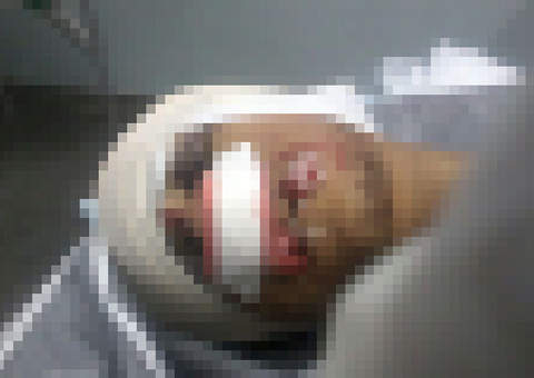 Trio é alvejado em troca de tiros com a polícia