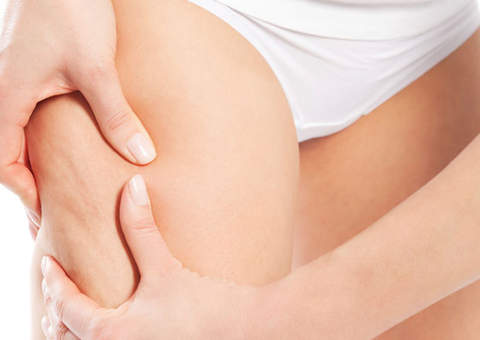 Confira 5 alimentos que combatem a celulite