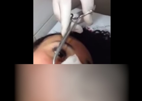  Bizarro: o que acontece quando uma mosca varejeira deposita ovos em uma pessoa 