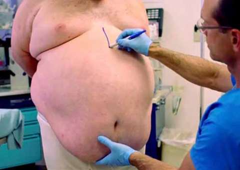 Vídeo chocante revela terrível realidade do consumo excessivo