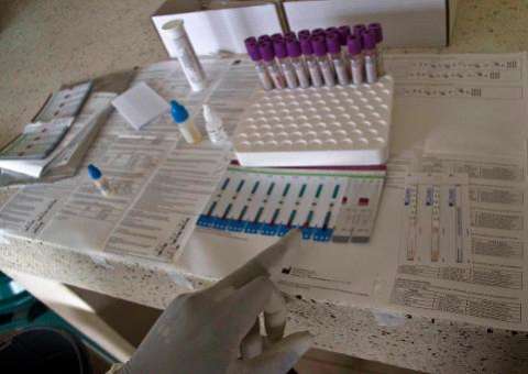 Pesquisa mostra que imunoterapia pode tratar o câncer