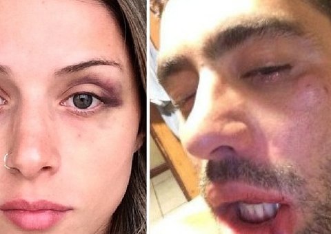  Namorada de ex-BBB Yuri conta MAIS detalhes de pancadaria 'achei que ia morrer'