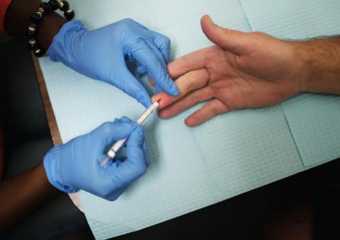   Traços de HIV voltam a aparecer em homens após transplante de medula