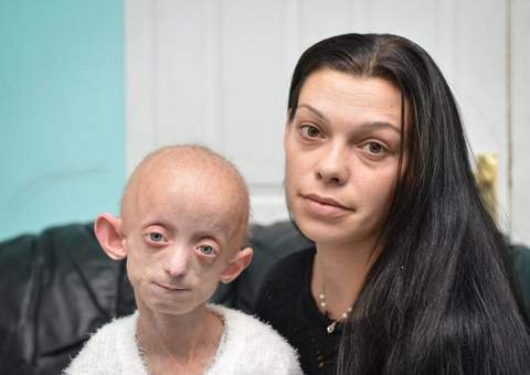 Menina com doença terminal é constrangida na escola 