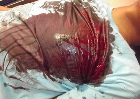 Ferido reclama de violência da Força Nacional no Rio