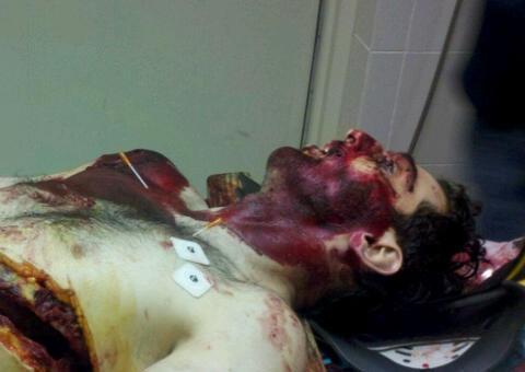 Suspeito de terrorismo em Boston teria sido executado pelo FBI. Imagens do que seria o corpo do jovem vazam na web