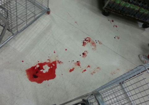 Em Manaus, idosa sai sangrando de supermercado após carrinho cortar sua perna