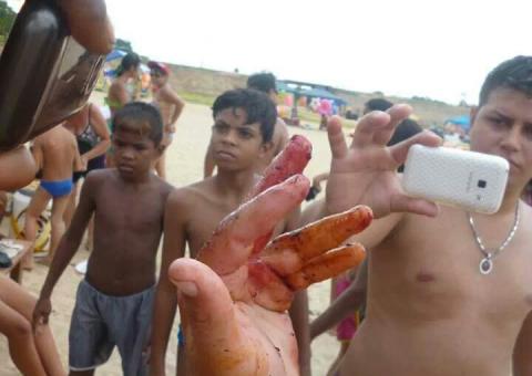 Quatro pessoas são atacadas por piranha em balneário no Amazonas