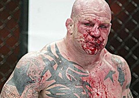 Russo nocauteia e deixa rosto de oponente desfigurado