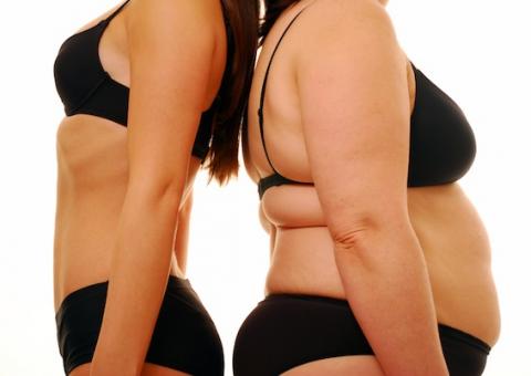 Após irmão morrer de obesidade, mulher ganha na Justiça direito de receber balão intragástrico