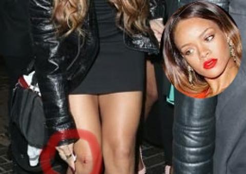  "Fã" joga garrafa em Rihanna por causa de Chris Brown