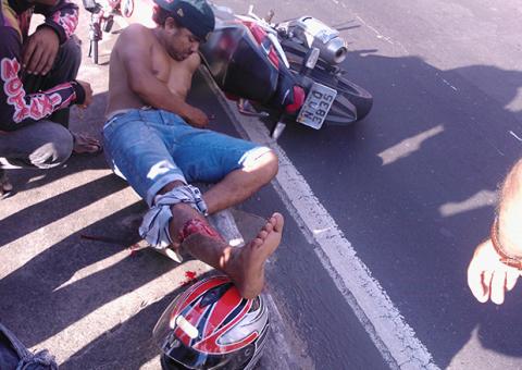 Micro ônibus tranca moto e rapaz tem perna atingida em acidente no V8