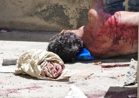 Morador de rua tem a garganta cortada durante a madrugada em Manaus 