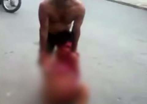 Mulher fala mal de sogra e tem a mão decepada pelo marido