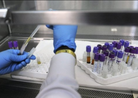 Epidemia de Aids pode acabar em 2030