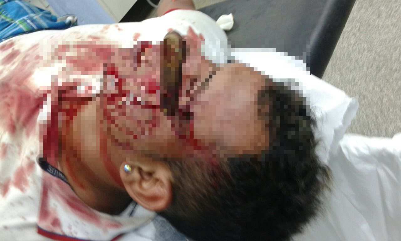 Homem leva facada no rosto e sobrevive