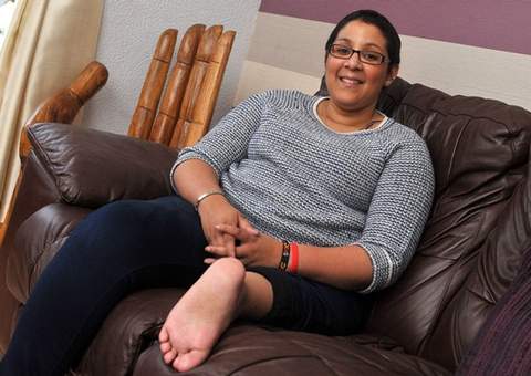 Mulher tem pé implantado no joelho em cirurgia 