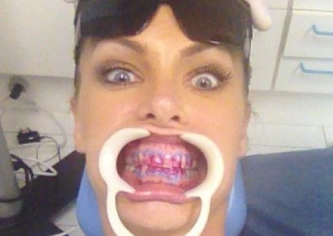  Ana Hickmann assusta fãs na web