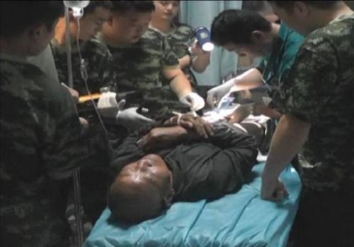 Idoso resolve colocar um anel no pênis e se dá mal