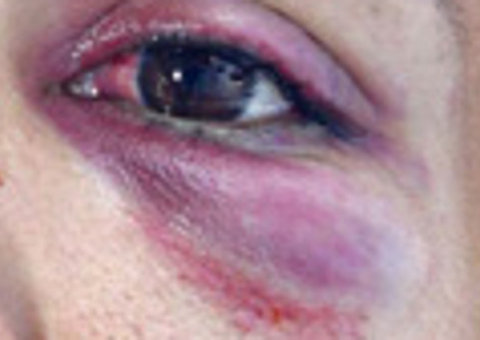 Homem não gosta de ser  chamado de safado e bate em mulher