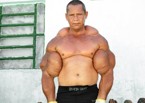  Confira os casos mais absurdos de uso de esteróides anabolizantes