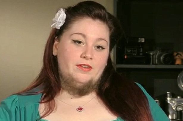 Marido diz que ama mulher como ela é e esposa assume barba