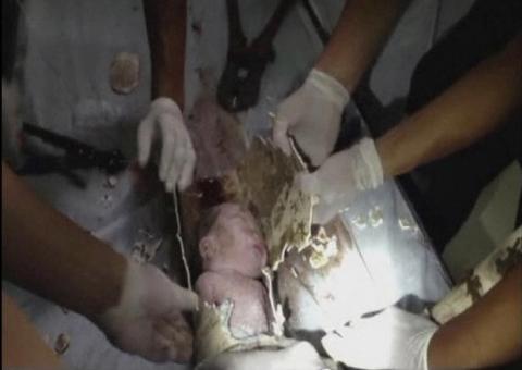 Bebê abandonado em cano de esgoto é resgatado na China