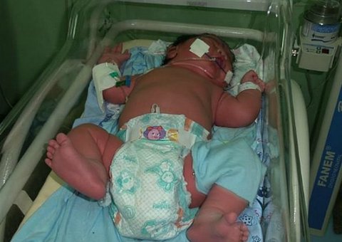 Gigante: Bebê de sete meses nasce com 6,7 quilos e 57 cm no interior do Amazonas
