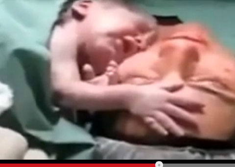 Bebê abraça a mãe logo após nascer