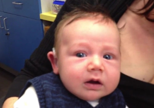 Vídeo de bebê com deficiência auditiva ouvindo pela primeira vez emociona