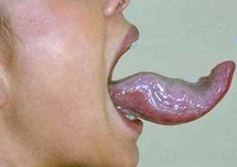 Bizarro, estudante alemã é a mulher com a maior língua do mundo