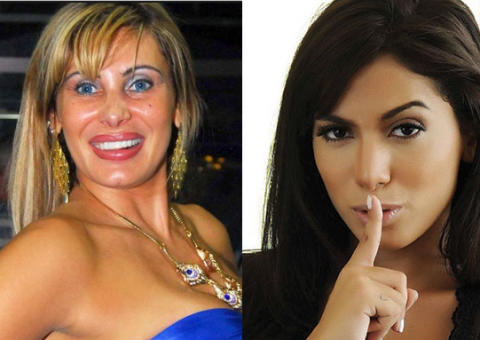 Ângela Bismarchi critica Anitta por cirurgias plásticas