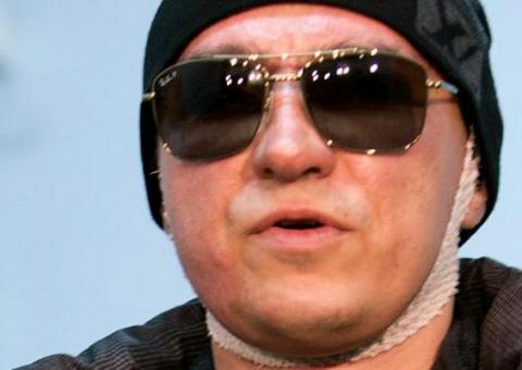 Diretor artístico do Bolshoi agredido com ácido volta a Moscou 