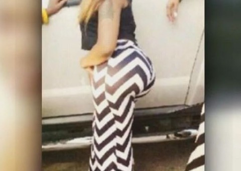  Americana morre após ficar viciada em hidrogel para ter "bumbum brasileiro"