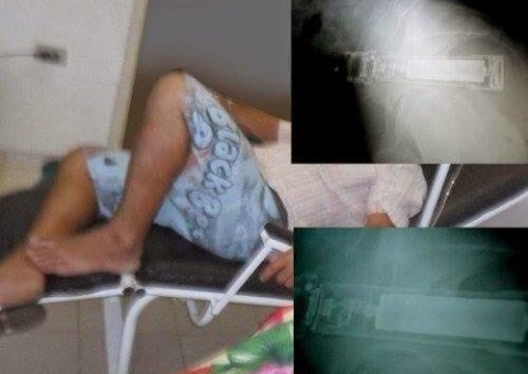 Caminhoneiro acorda com lanterna no ânus