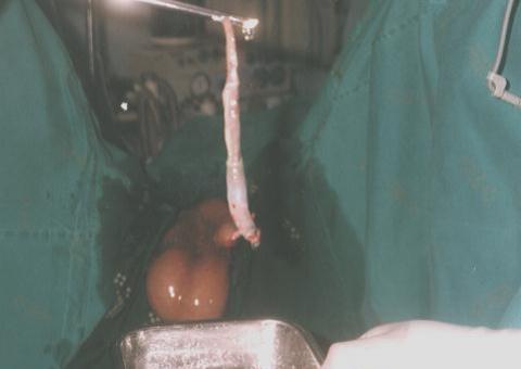 A lenda do Candiru. Será que é lenda mesmo?